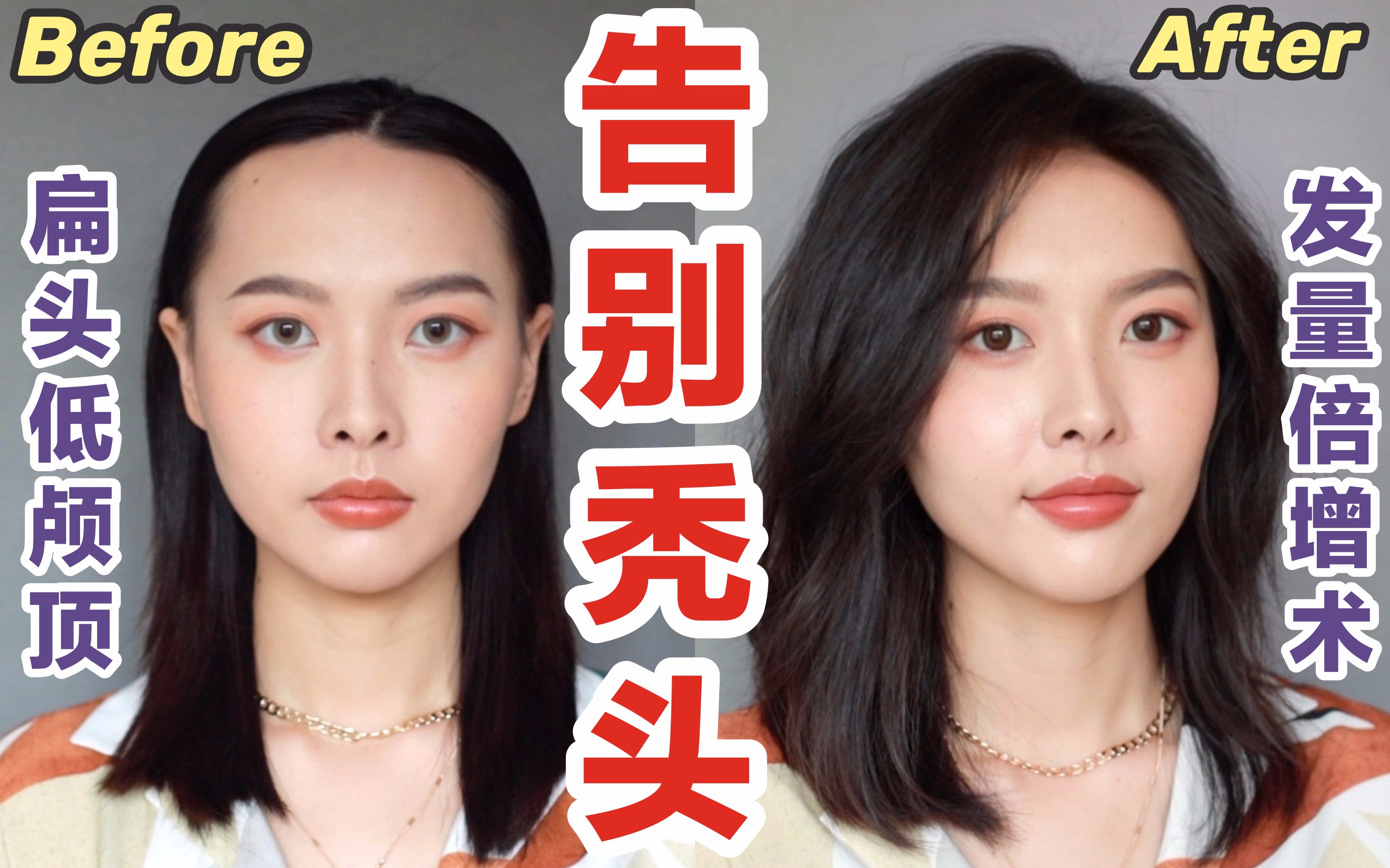 秃头女孩发量倍增术不植发改善低颅顶超详细卷发教程鱼章