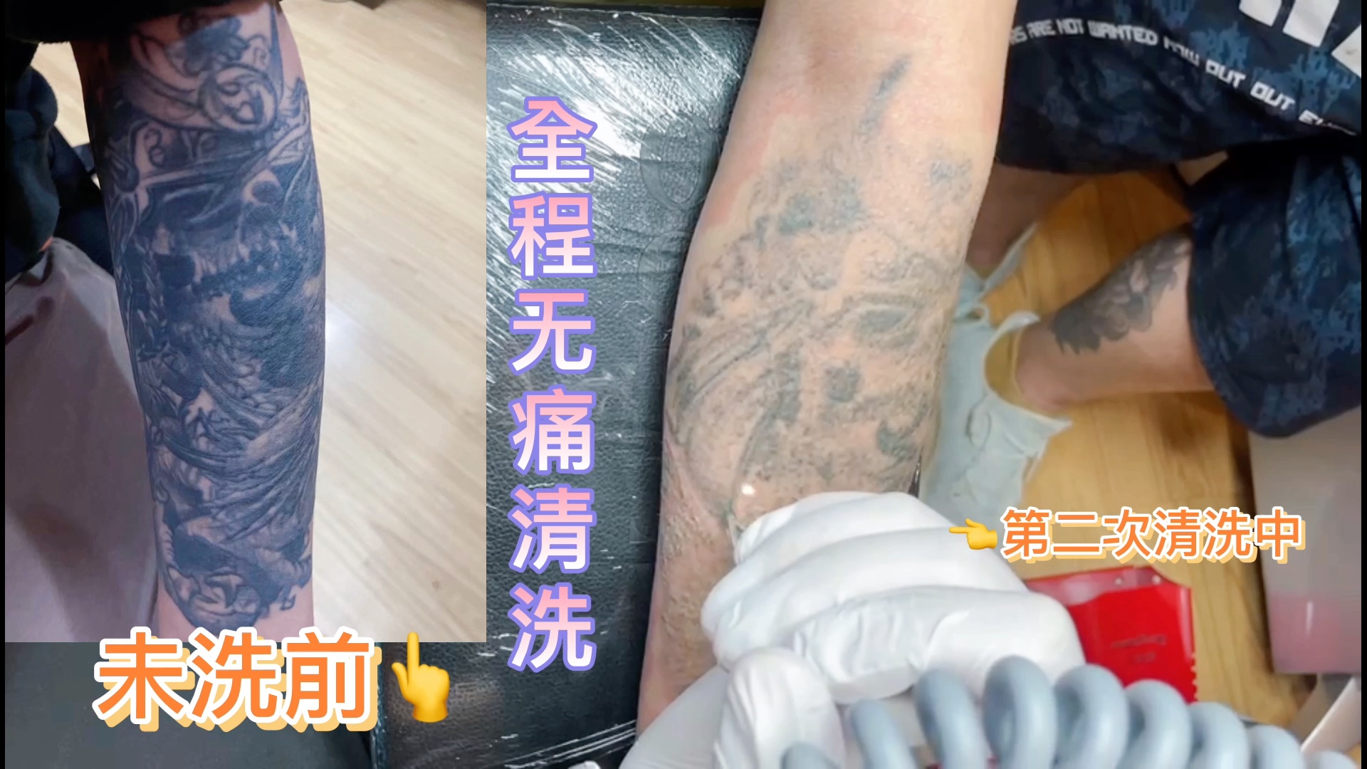 洗纹身一次效果