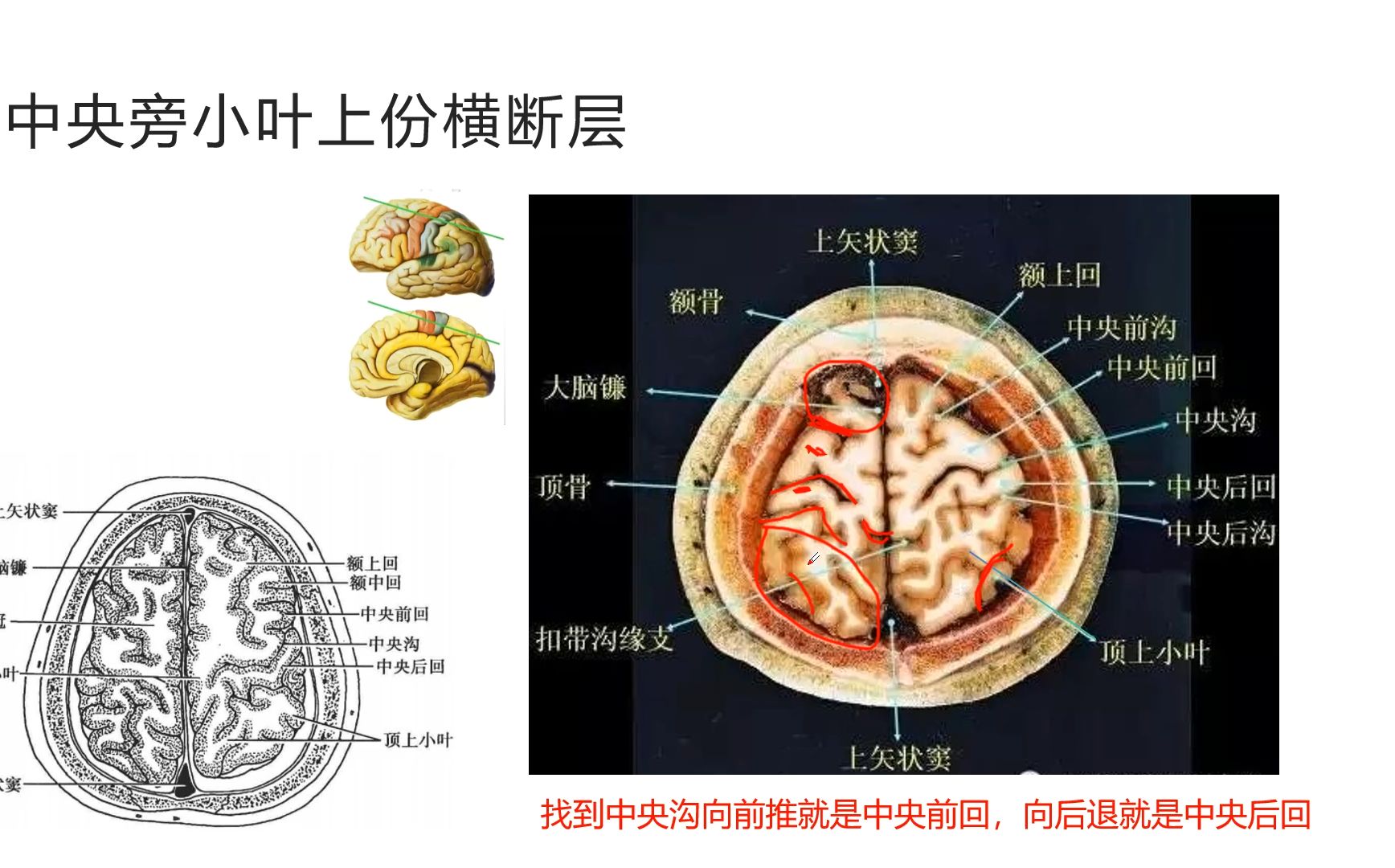 脑桥横断面解剖图图片