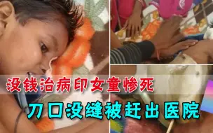 Download Video: 说好的免费医疗呢？印度3岁女童惨死医院门口，手术刀口还没缝上