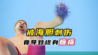 Video herunterladen: 被海胆刺伤，竟导致终身瘫痪！那如何正确处理？