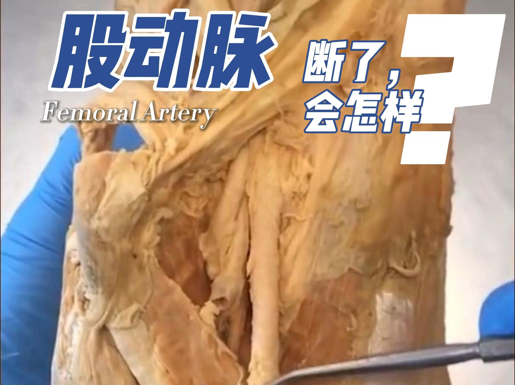 femoral artery图片