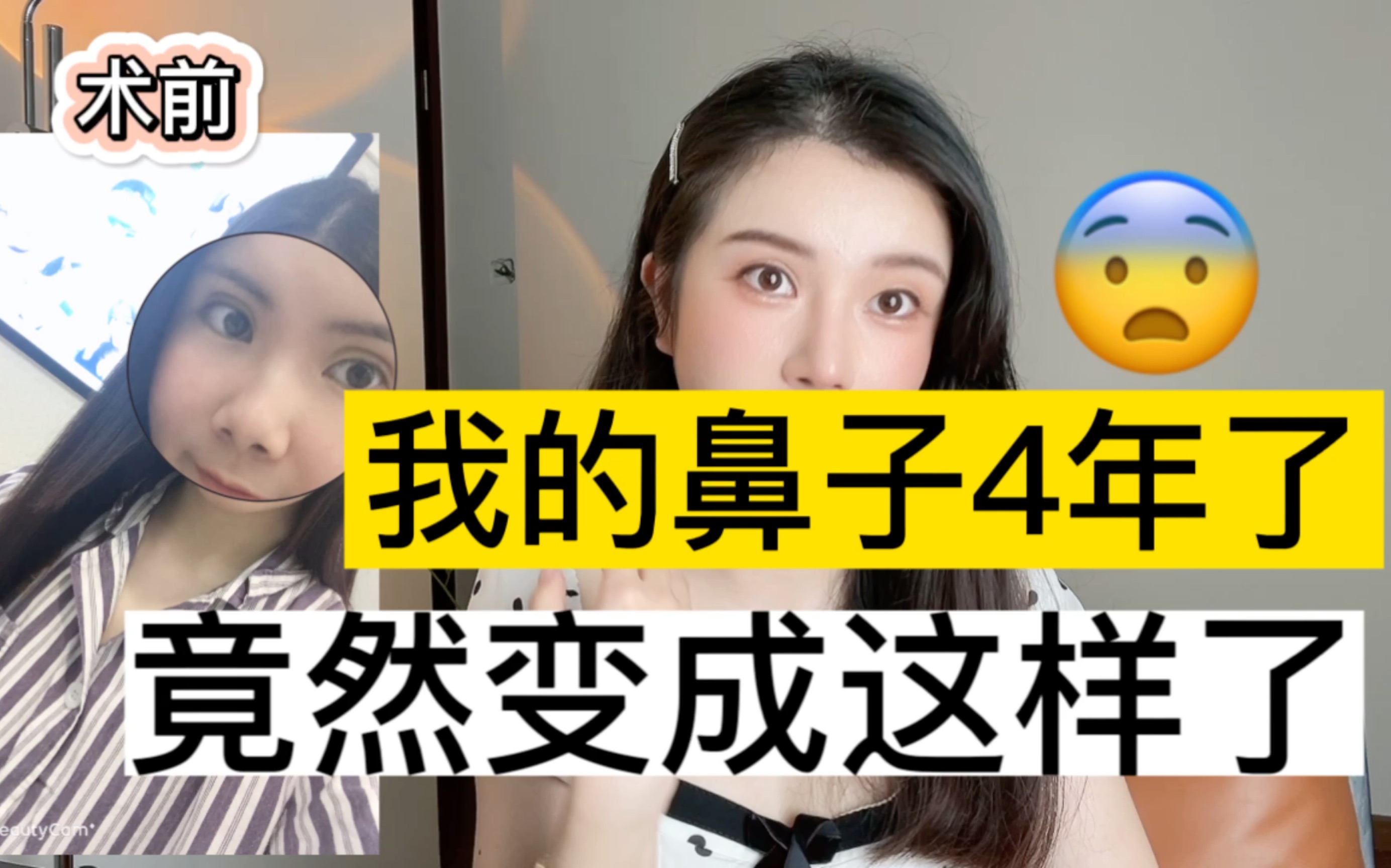 第一次隆鼻如何做到不翻车哔哩哔哩bilibili