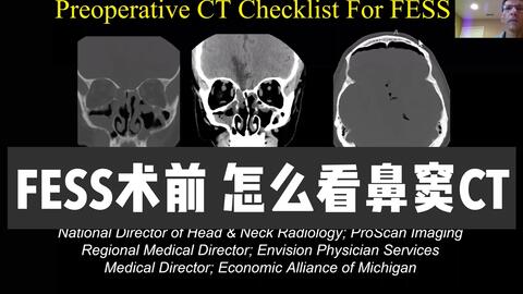 影像系列 医学英语 影像大佬教你鼻内镜术前鼻窦ct都需要报告哪些内容 哔哩哔哩