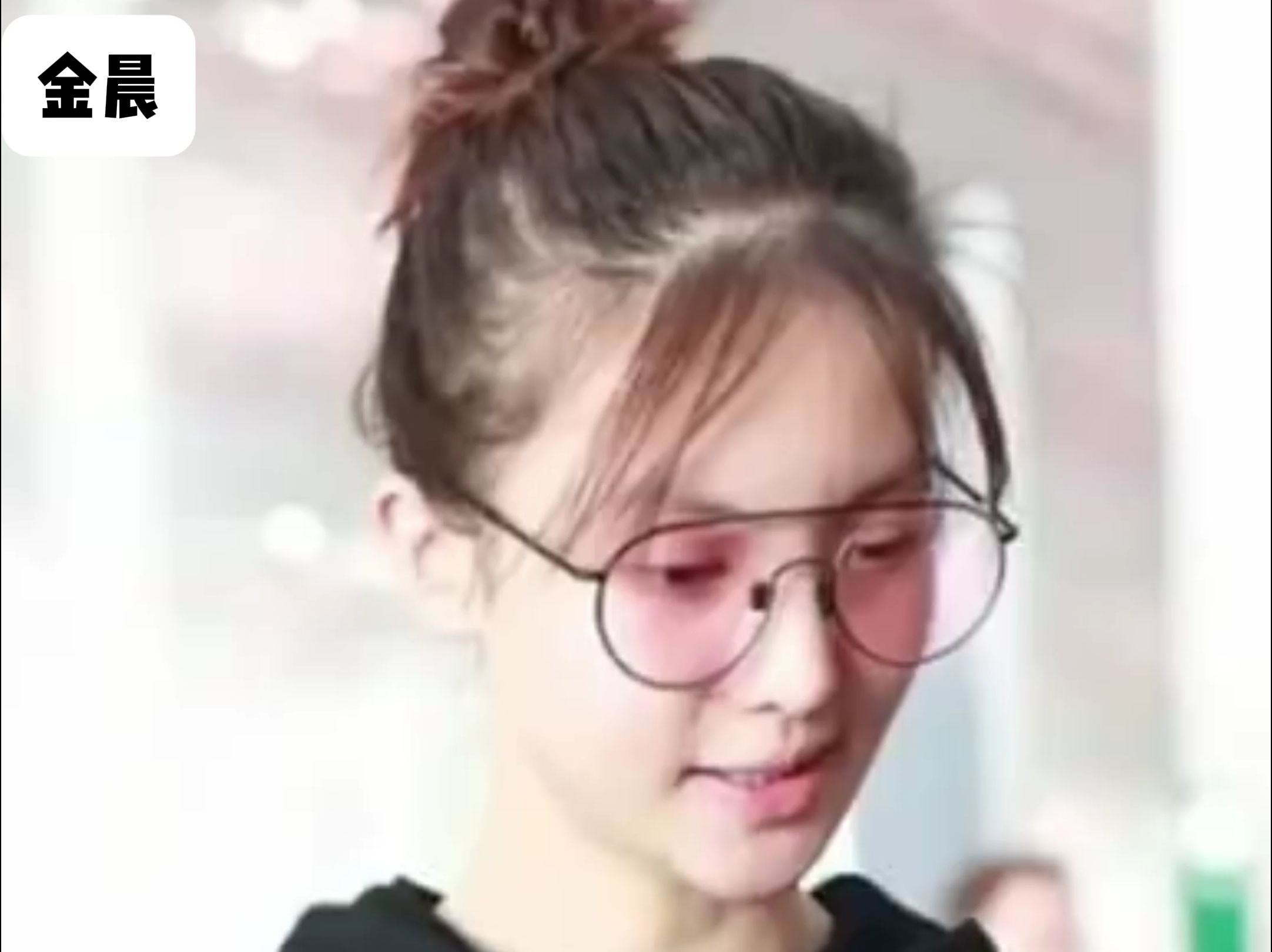 原来金晨的头发这么稀少啊!后脑勺直接秃了一大块