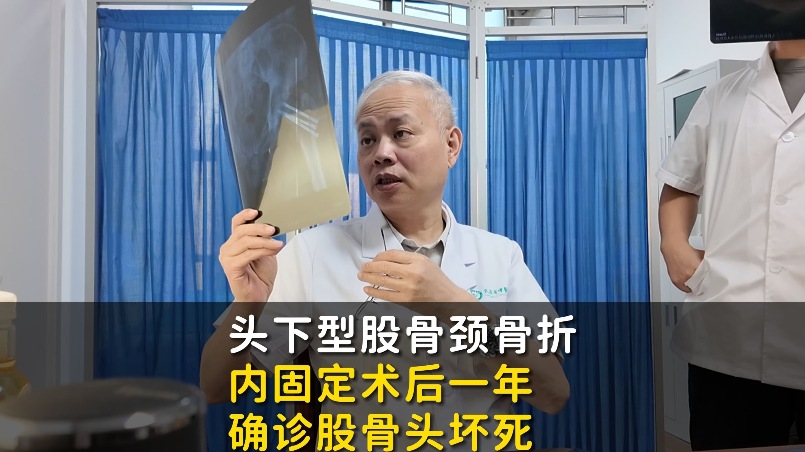 确诊了！头下型股骨颈骨折术后一年，复查核磁发现股骨头坏死