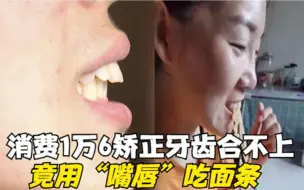 女子消费1万6矫正牙齿挨不上，竟用嘴唇咬面条，医院：正常的