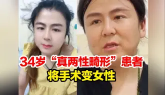 Download Video: 34岁“真两性畸形”患者将手术变女性：不想再被喊“双性人”，父母不支持 还将联系方式拉黑