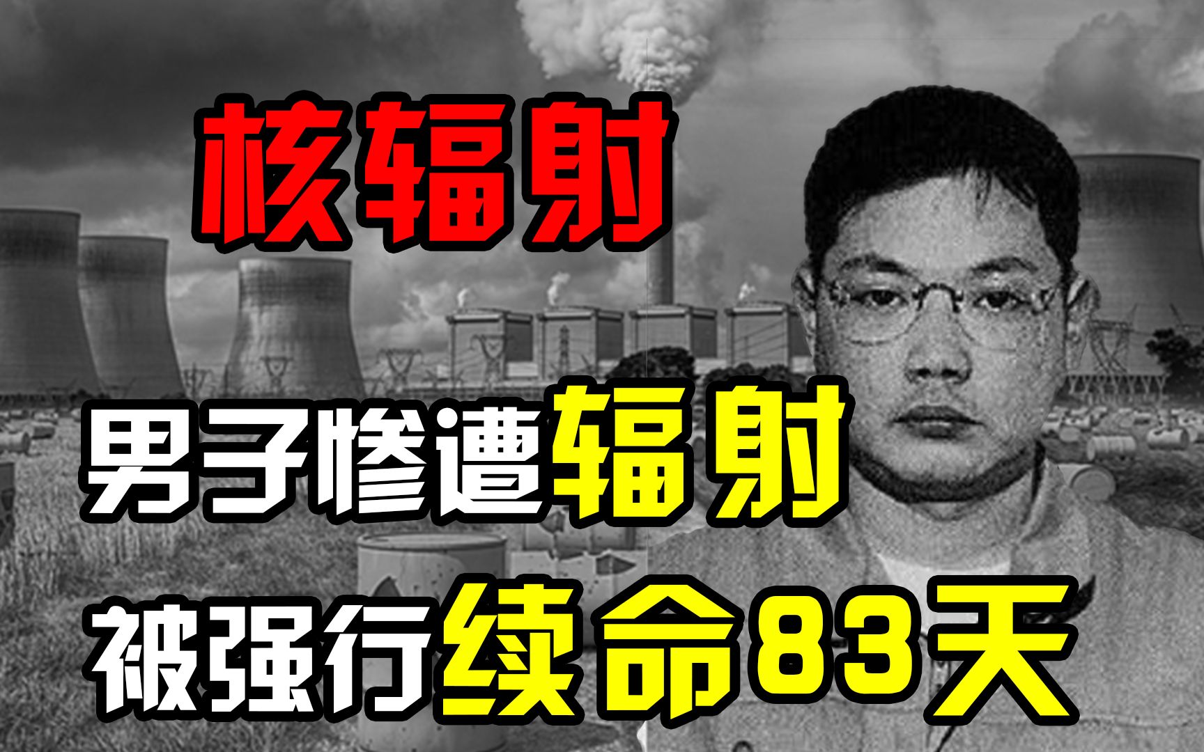 核辐射有多恐怖?日本男子遭核辐射后,被强行续命83天拍成纪录片!哔哩哔哩bilibili