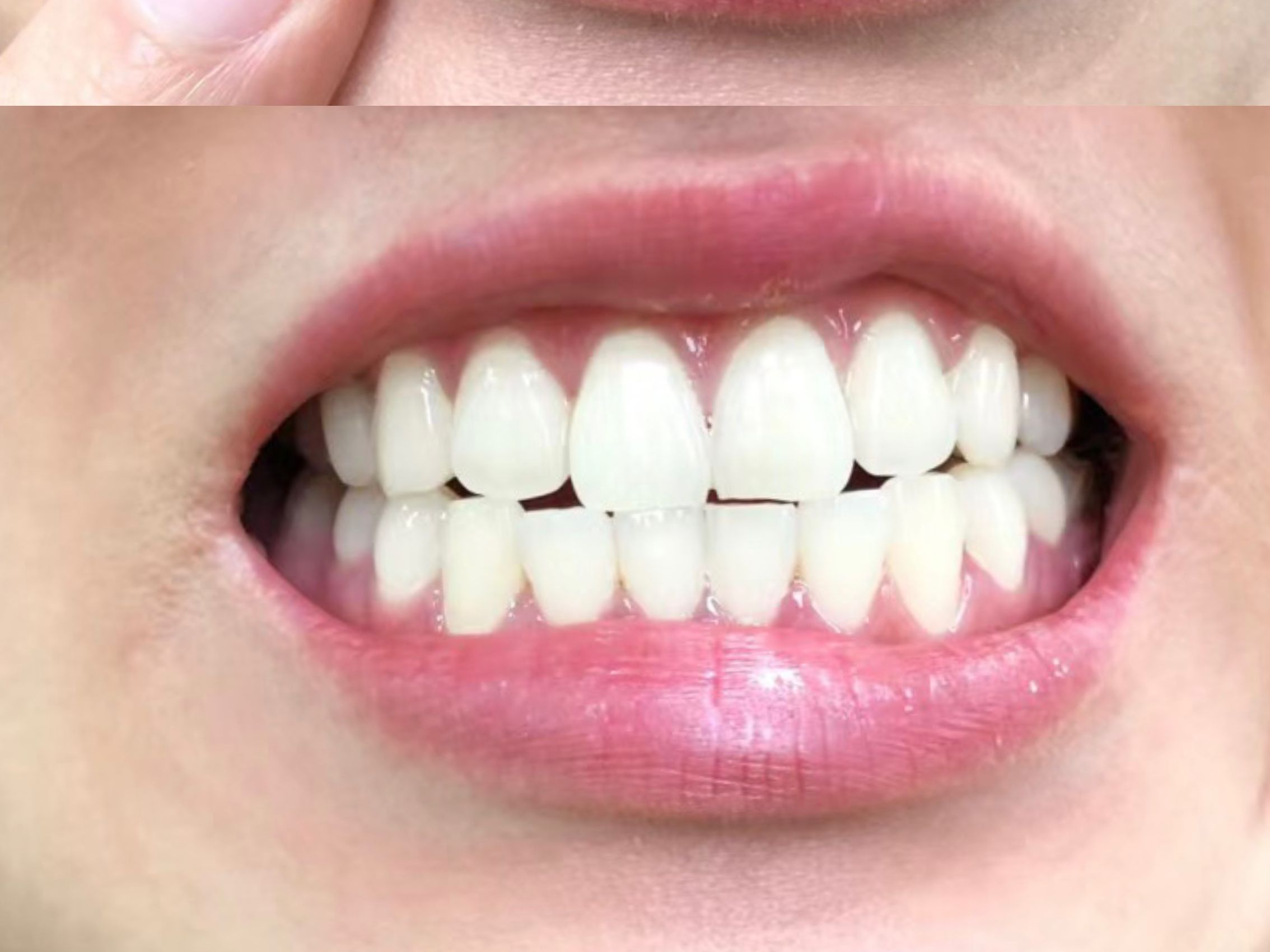 刷牙加上它就行了!在家也能逆袭白牙!