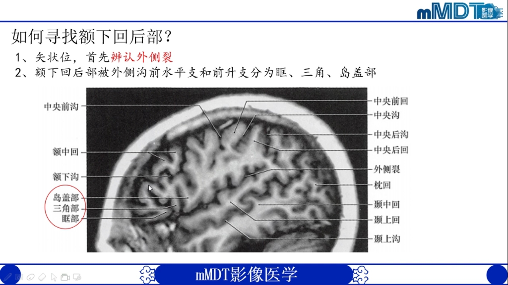 [图]mMDT神经影像基础班01:颅脑影像解剖（一）