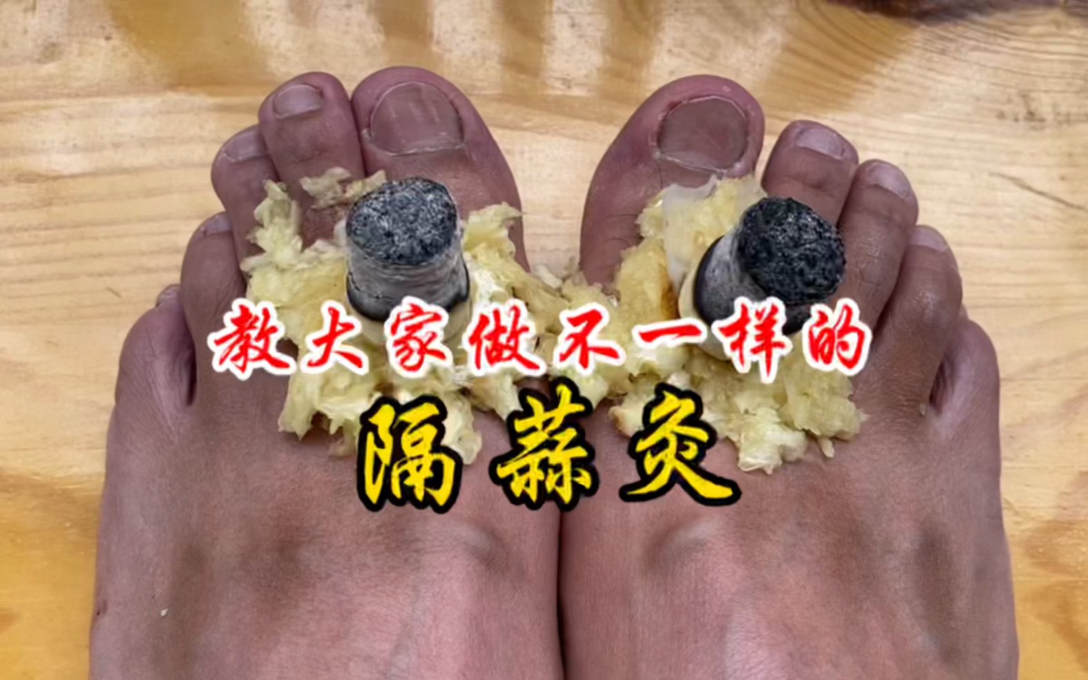 教大家做不一样的隔蒜灸