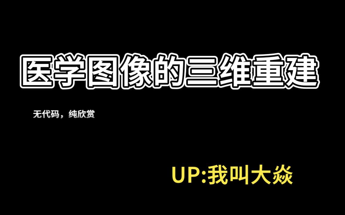 医学图像的三维重建(初步成果)哔哩哔哩bilibili