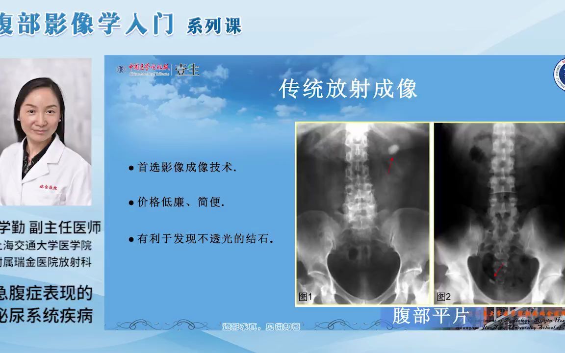 【腹部影像学入门】Day23 急腹症表现的泌尿系统疾病哔哩哔哩bilibili