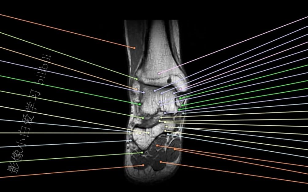 小腿磁共振解剖图谱图片