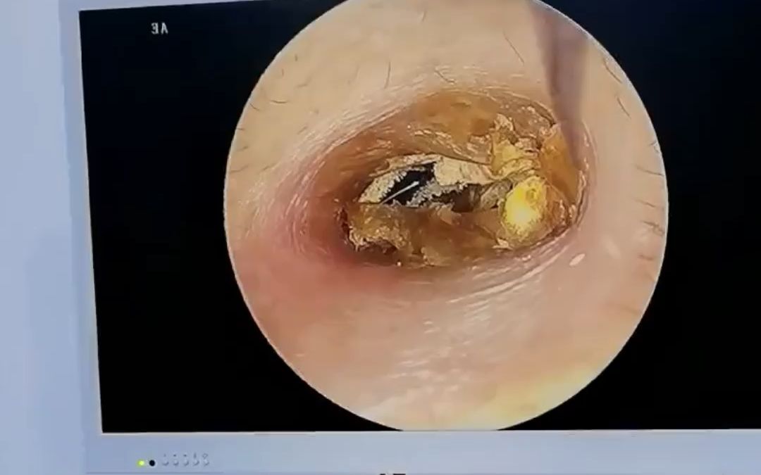 这个视频给你答案!放心解压又下饭.