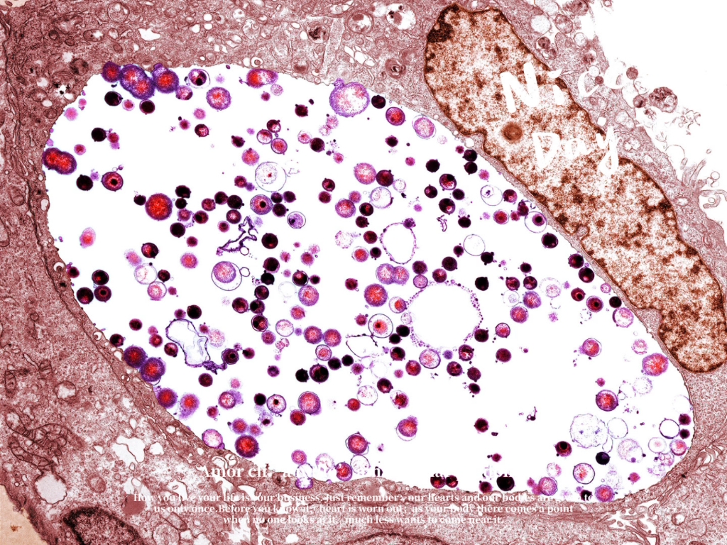 chlamydia trachomatis02bacteria#沙眼衣原体细菌