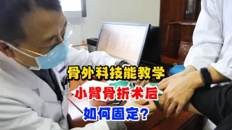 Descargar video: 骨外科技能教学，小臂骨折shu后，如何固定？