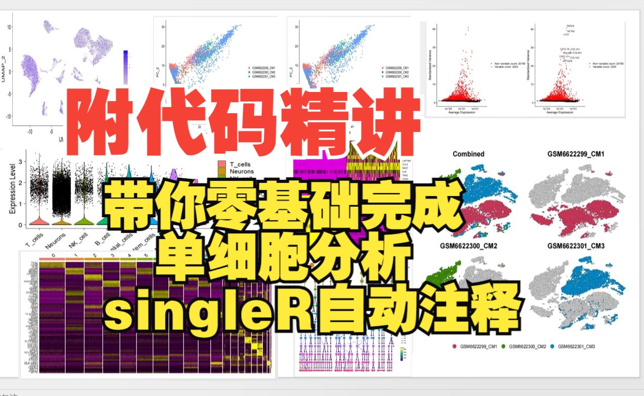 02(附代码)入门必看、带你零基础学单细胞分析!标准流程、singleR自动注释精讲!!哔哩哔哩bilibili