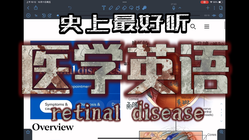 每日一篇医学英语|retinal disease视网膜疾病哔哩哔哩bilibili