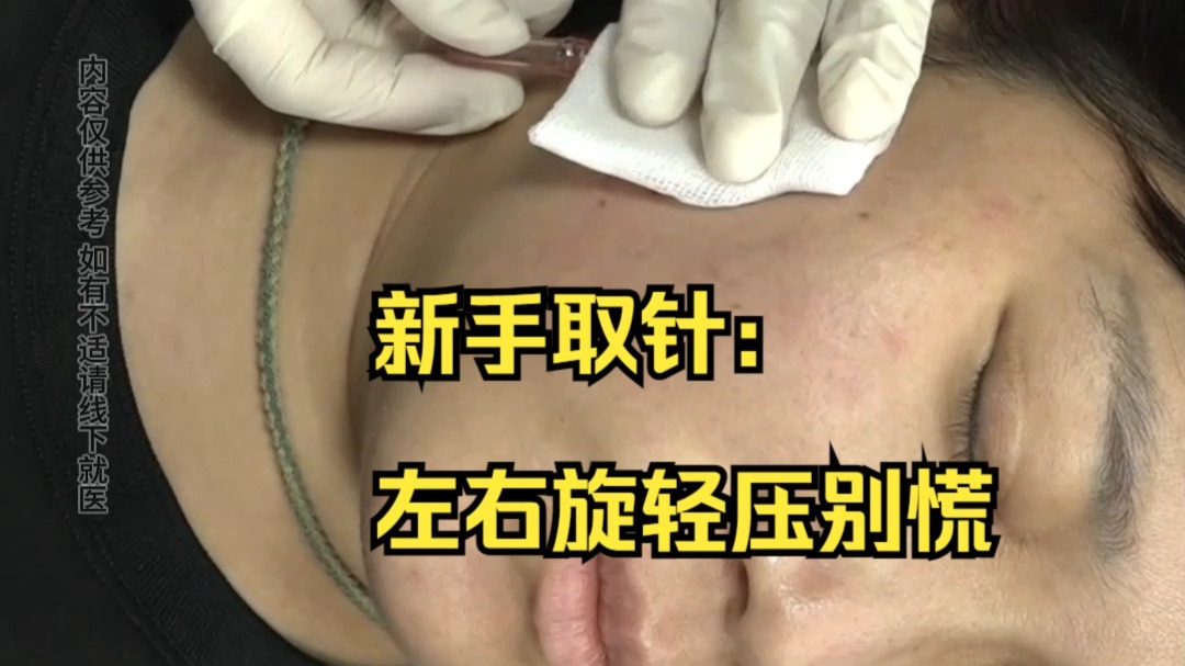 新手取针：左右旋轻压别慌