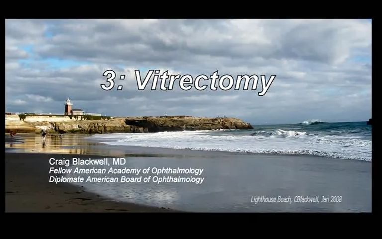 【中英双字】【玻璃体切除术/玻切】Vitreous 3 Vitrectomy Surgery哔哩哔哩bilibili