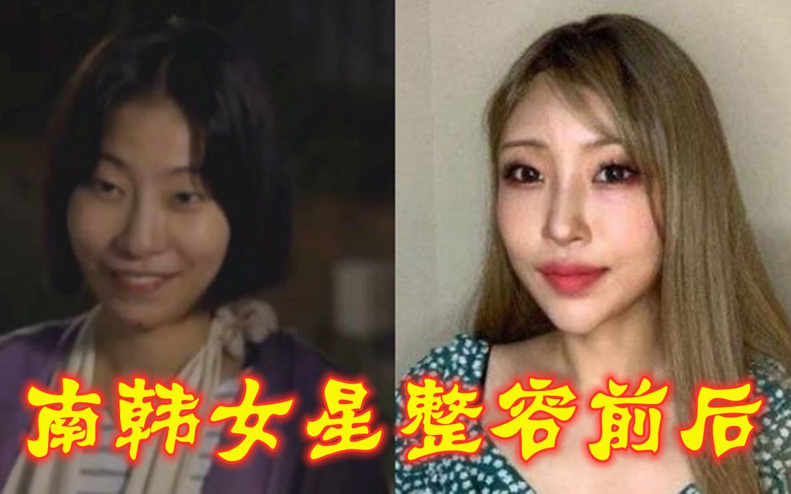 女星整容前后,李多海取出假体重回巅峰,“双门洞王祖贤”丑小鸭变女王哔哩哔哩bilibili