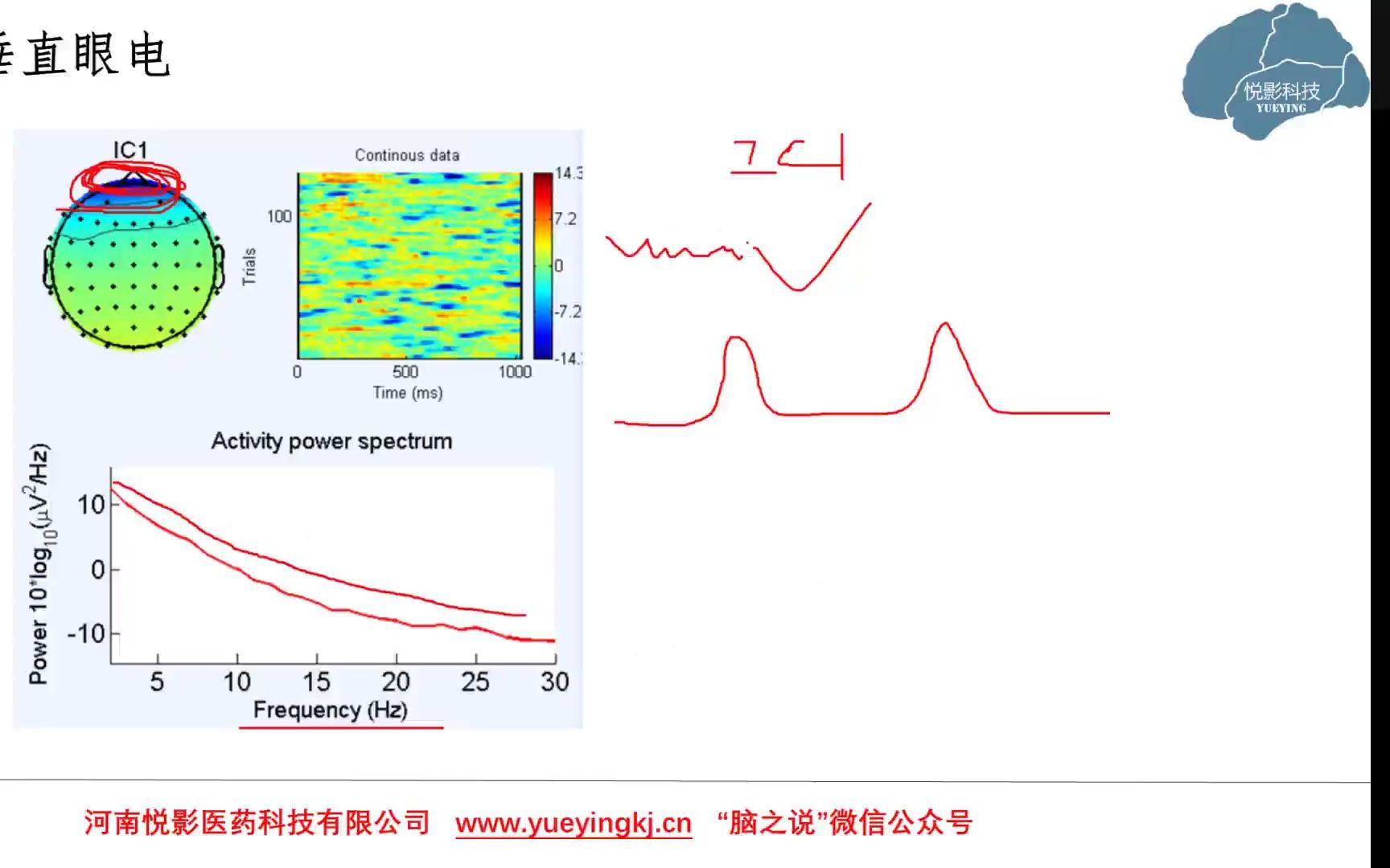 EEG\ERP基础知识系列讲座第44讲:脑电中的眼电伪迹及ICA鉴别哔哩哔哩bilibili