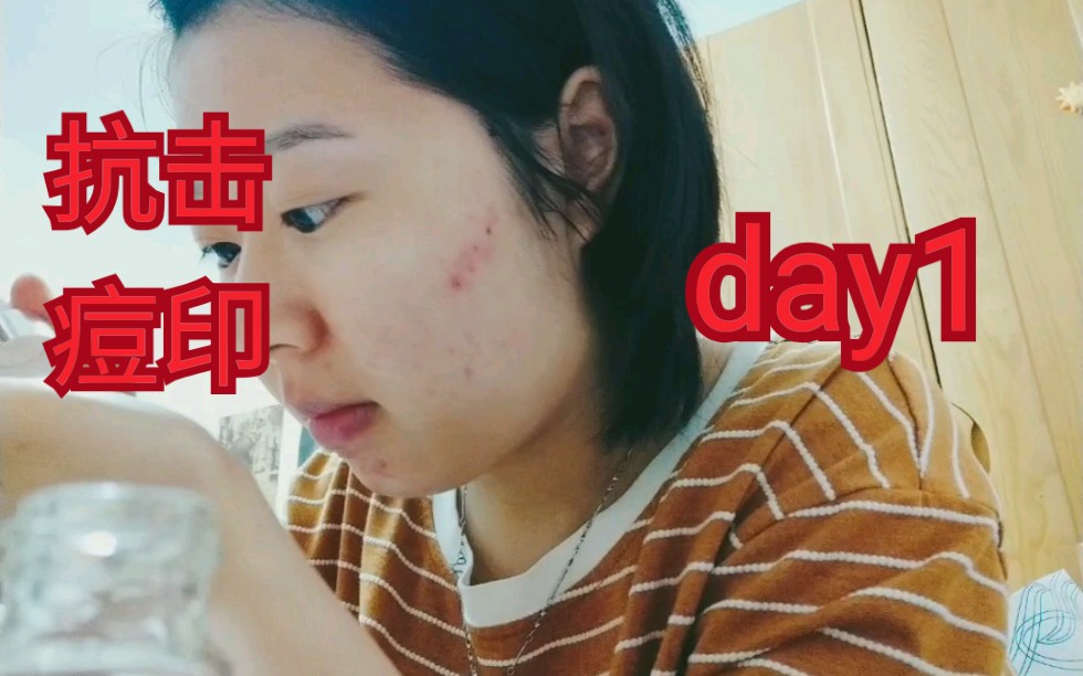 护肤小白的护肤vlog/day1/一清堂祛痘印/想跟你们一起成长哔哩哔哩bilibili