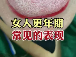 Download Video: 女人更年期 常见的表现