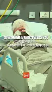 Download Video: 黎巴嫩通讯设备爆炸已致37死 当地眼科医生：一晚摘的眼球比之前加起来还多