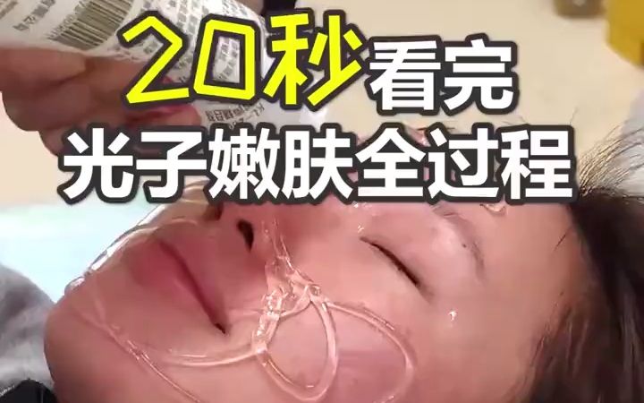 20秒看完光子嫩肤全过程哔哩哔哩bilibili