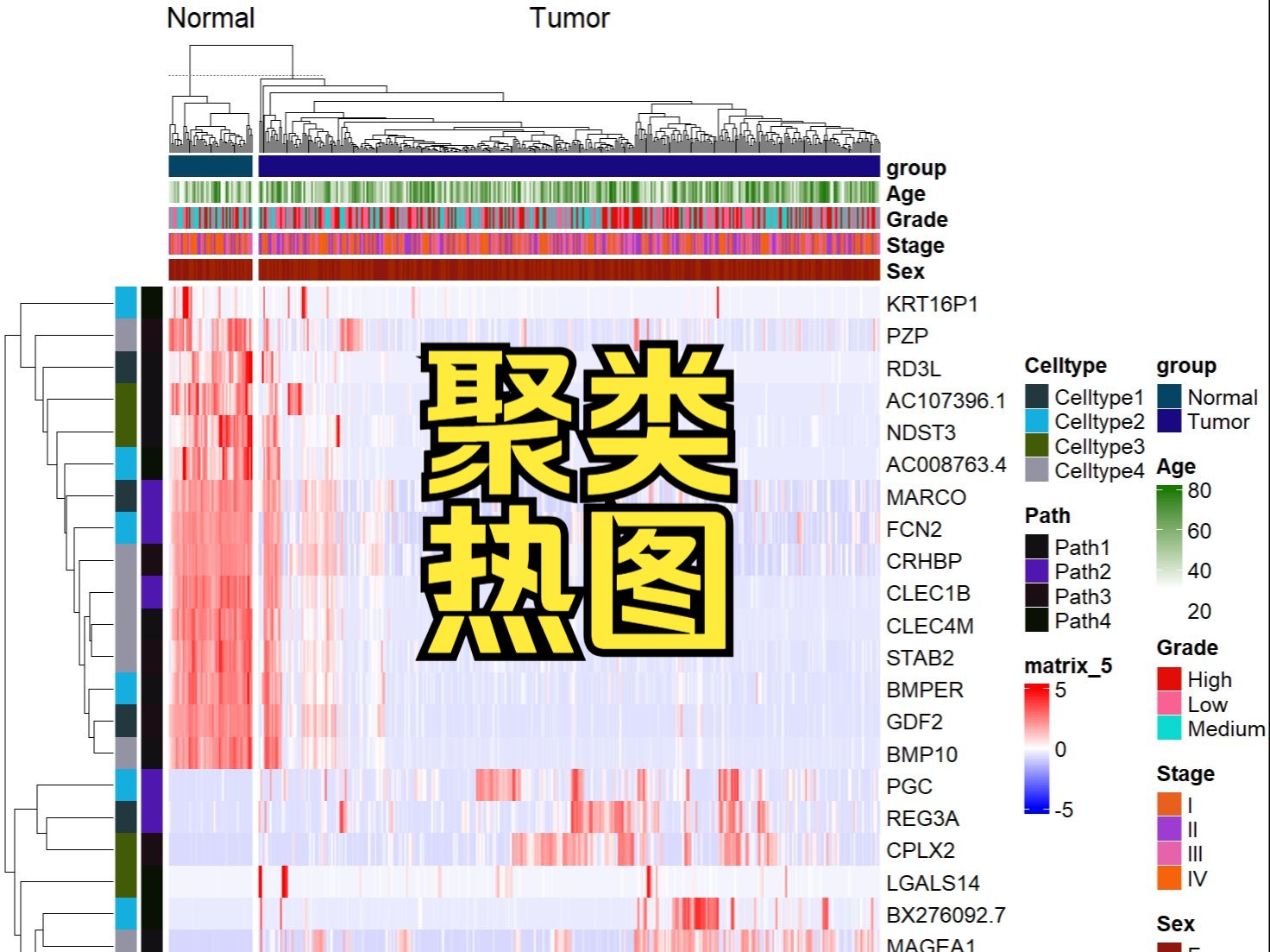 差异基因可视化—— 高颜值聚类热图 | Bulk转录组专题哔哩哔哩bilibili