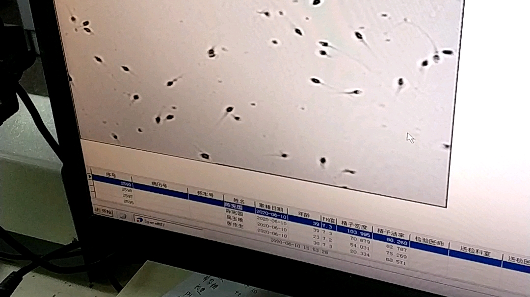 显微镜下的小蝌蚪