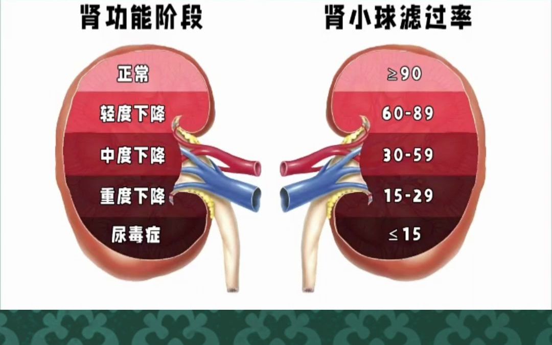 [图]慢性肾脏病分期表，你到第几期了？