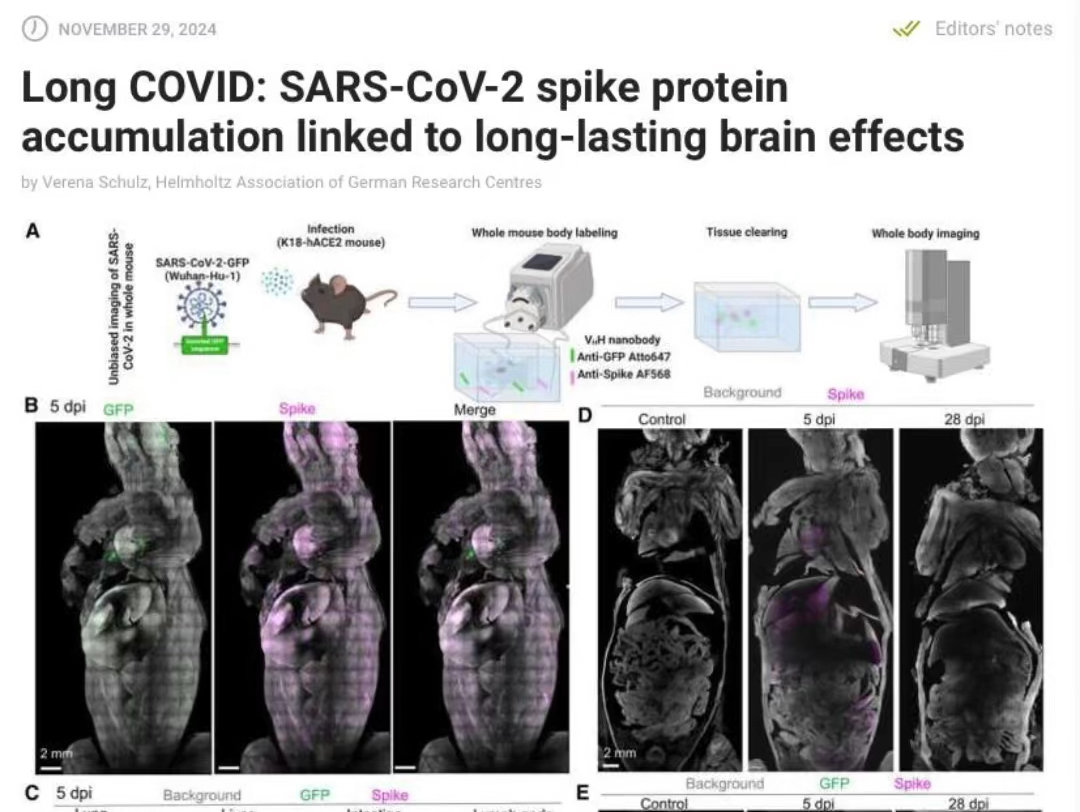 Medical Xpress:长新冠的长期大脑影响与新冠病毒刺度蛋白的积累相关(文章内容在简介)哔哩哔哩bilibili