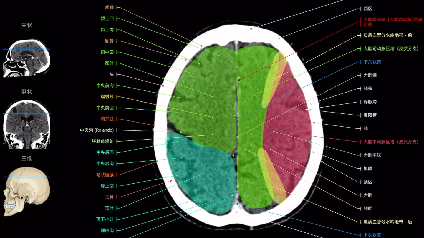 [图]e-anatomy中文版影像解剖图谱，颅脑CT