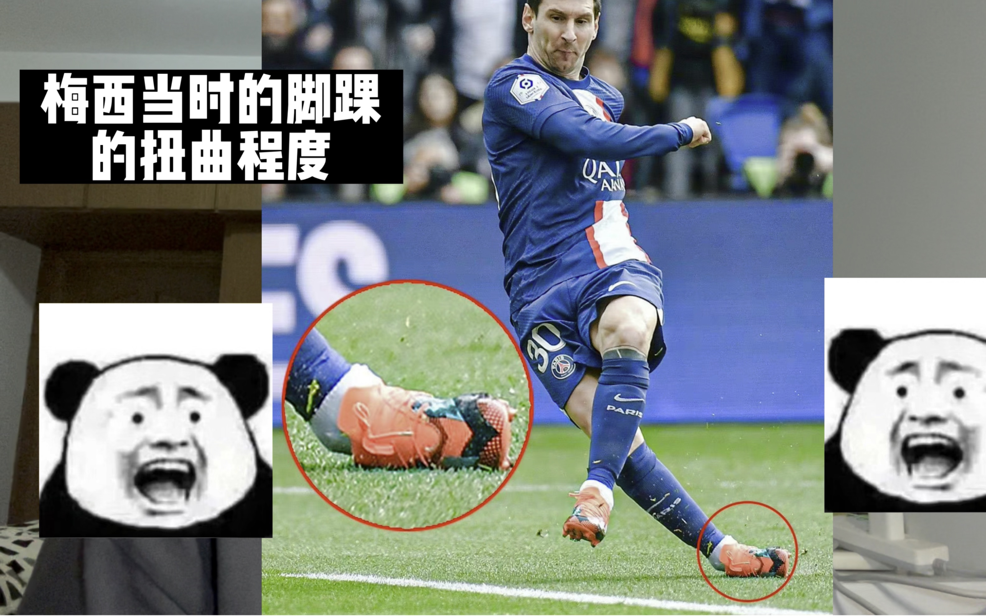 梅西的脚踝真的很夸张!