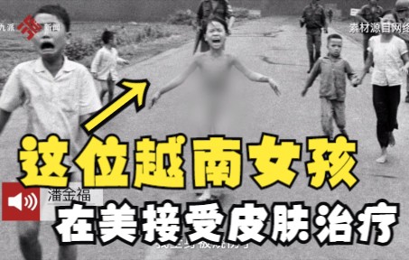 越南“凝固汽油弹女孩”在迈阿密接受最后一次皮肤治疗,距离她被汽油弹袭击已过去了50年哔哩哔哩bilibili