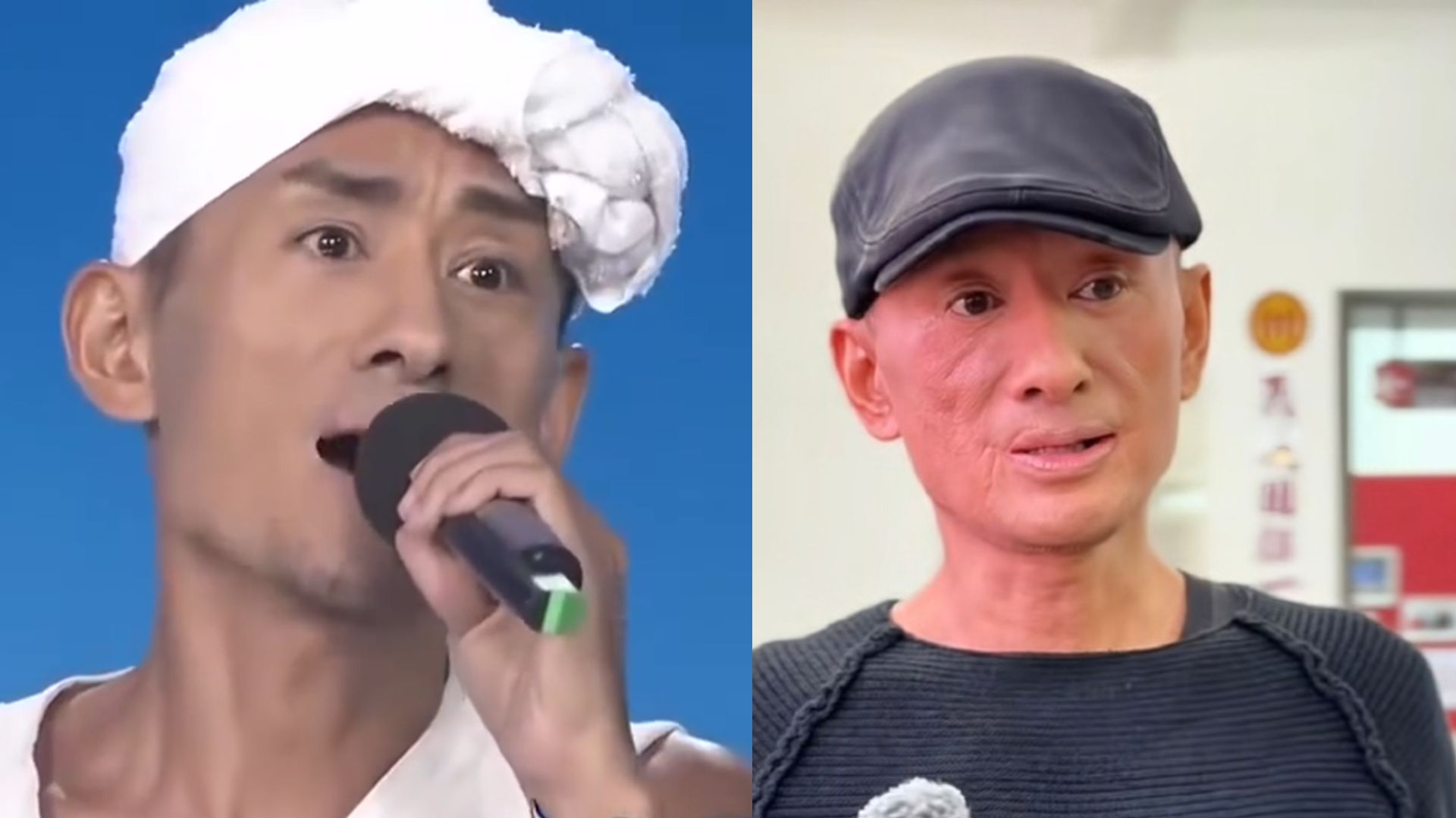 昔日央视冠军阿宝脸怎么了？面部纹路诡异，网友直呼完全认不出