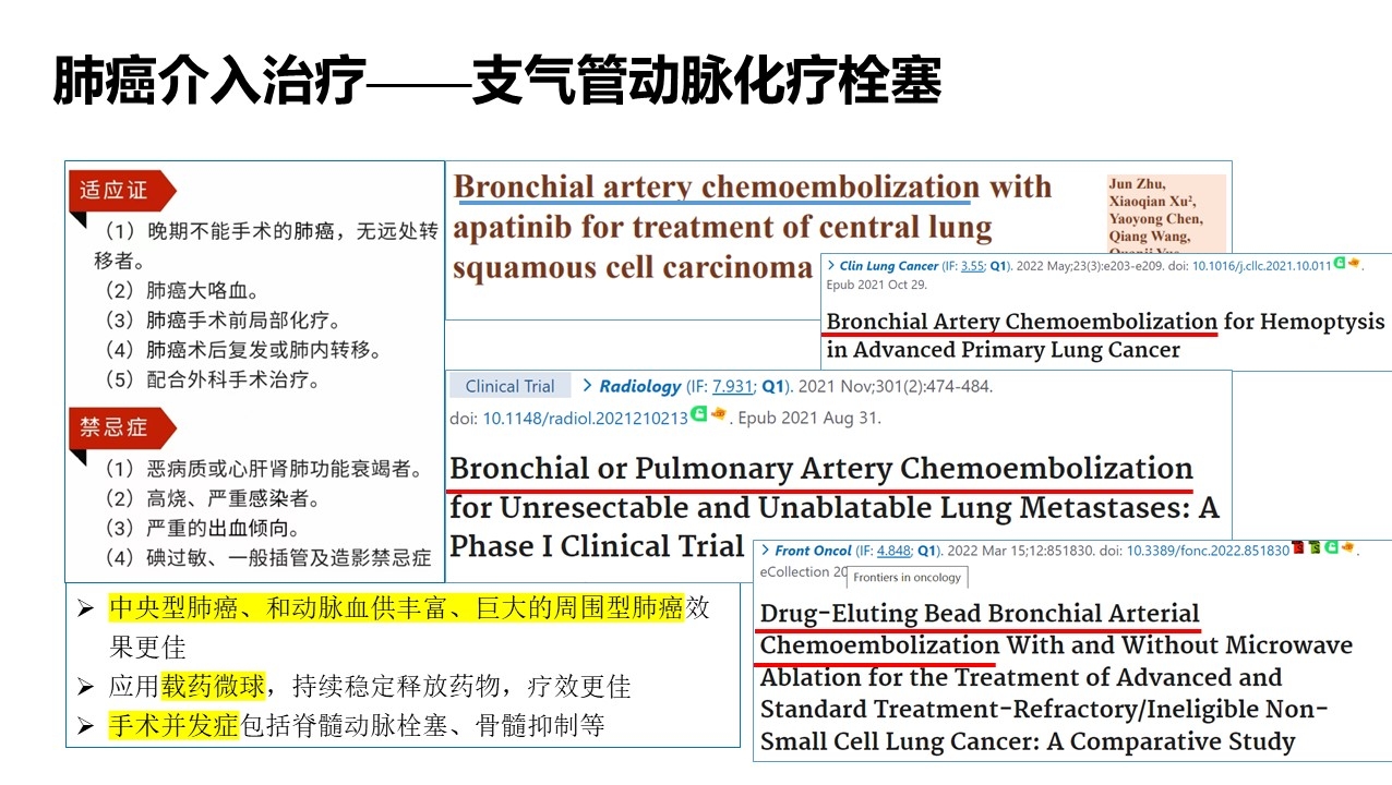 肺癌介入治疗——支气管动脉化疗栓塞哔哩哔哩bilibili