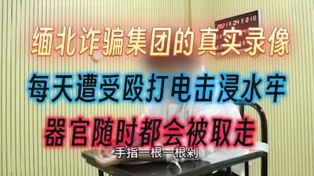 [图]缅北诈骗集团的真实录像，每天遭受殴打电击浸水牢，器官随时都会被取走。