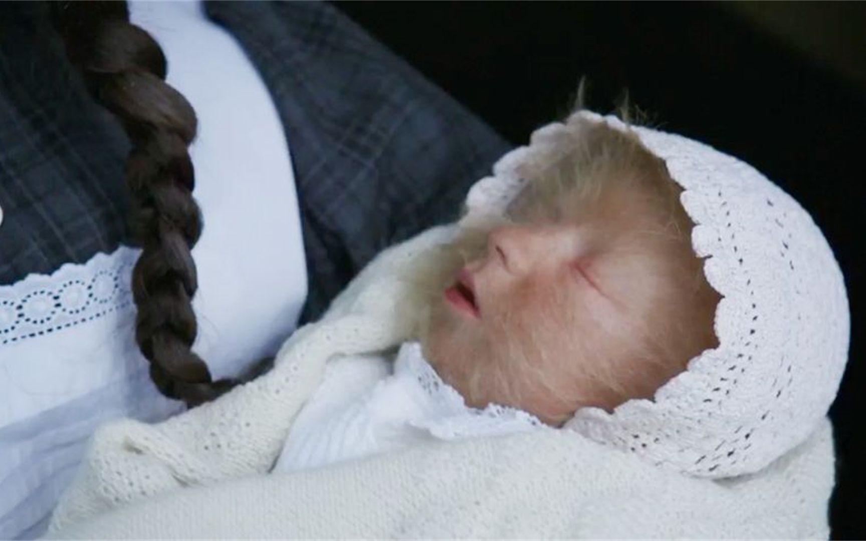 女孩刚出生长相异于常人,接生医生抱过来一看,吓得差点扔了出去