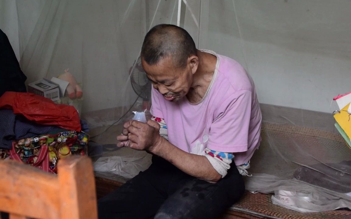 关爱麻风病患者,被遗忘的生命不该被忽略