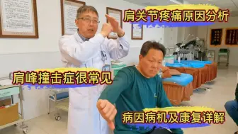 Descargar video: 肩关节疼痛原因分析，肩峰撞击症很常见，病因病机及康复详解