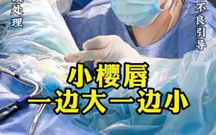 Download Video: 小樱唇不对称一边大一边小