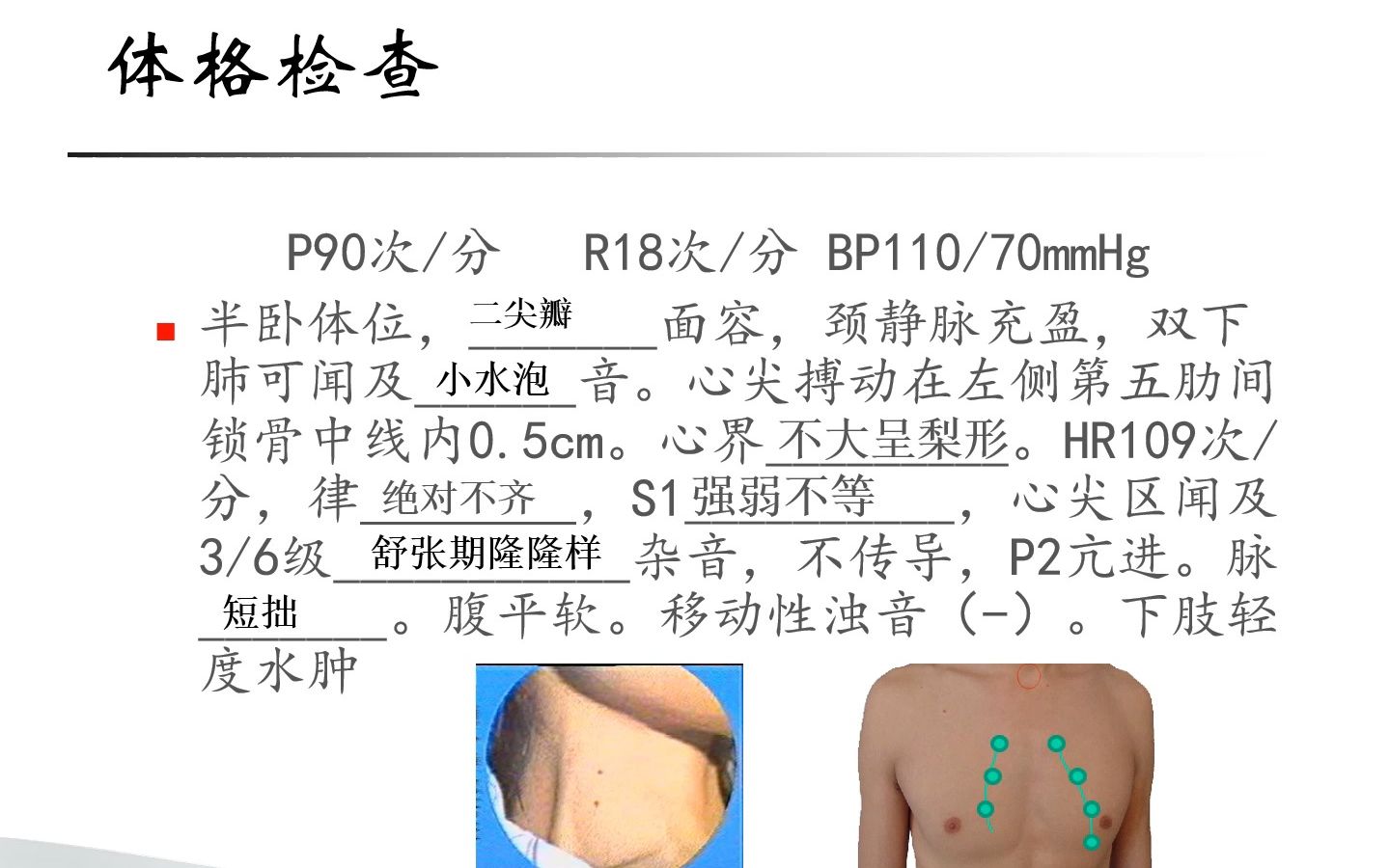 心血管疾病病例讨论PPT哔哩哔哩bilibili