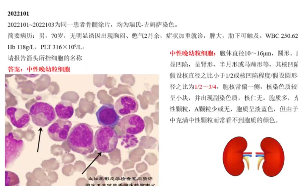 【血细胞形态质评解读微课堂】第二讲#国家卫生健康委临床检验中心2022年第1次哔哩哔哩bilibili