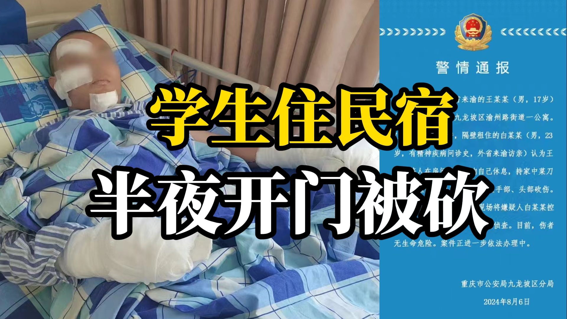 准大学生重庆旅游夜宿民宿 半夜遇敲门对方上来就砍 警方通报哔哩哔哩bilibili