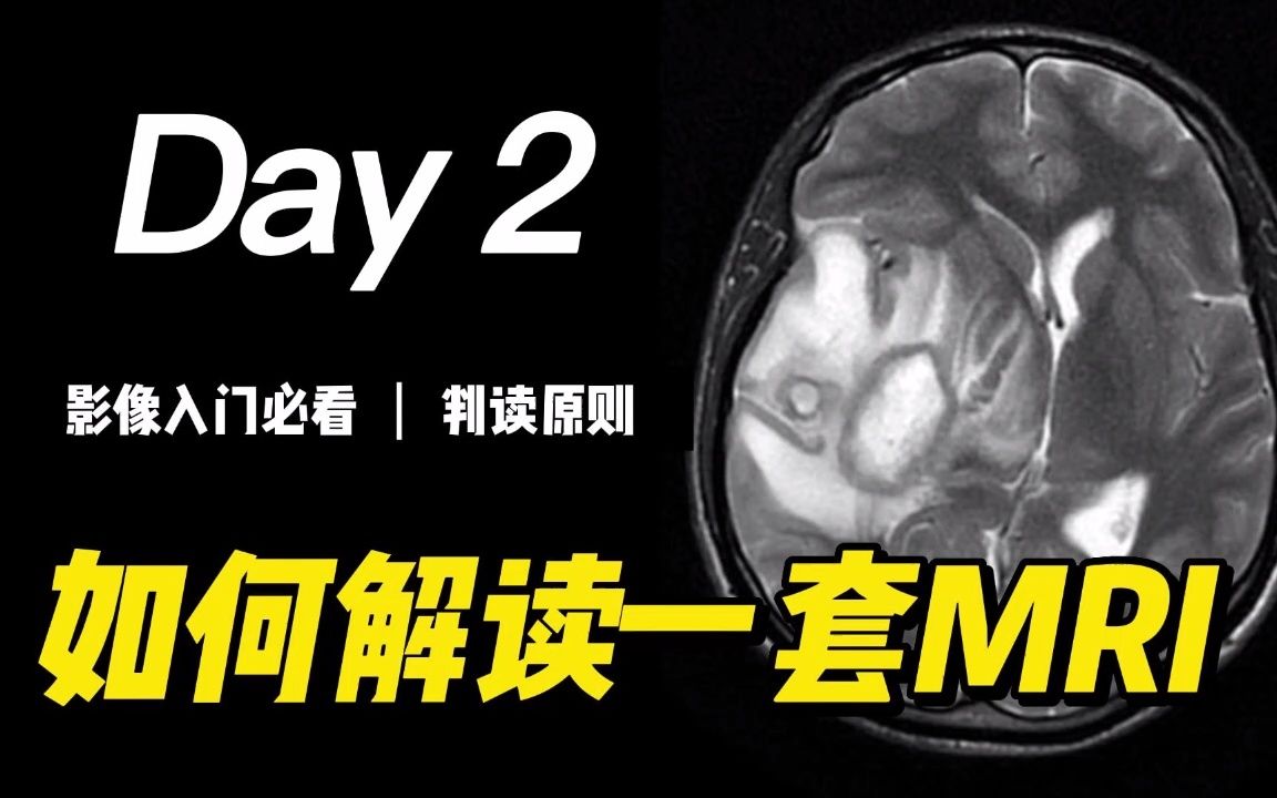 如何解读一套MRI:判读原则 | 磁共振成像、医学影像、放射科、杨正汉哔哩哔哩bilibili